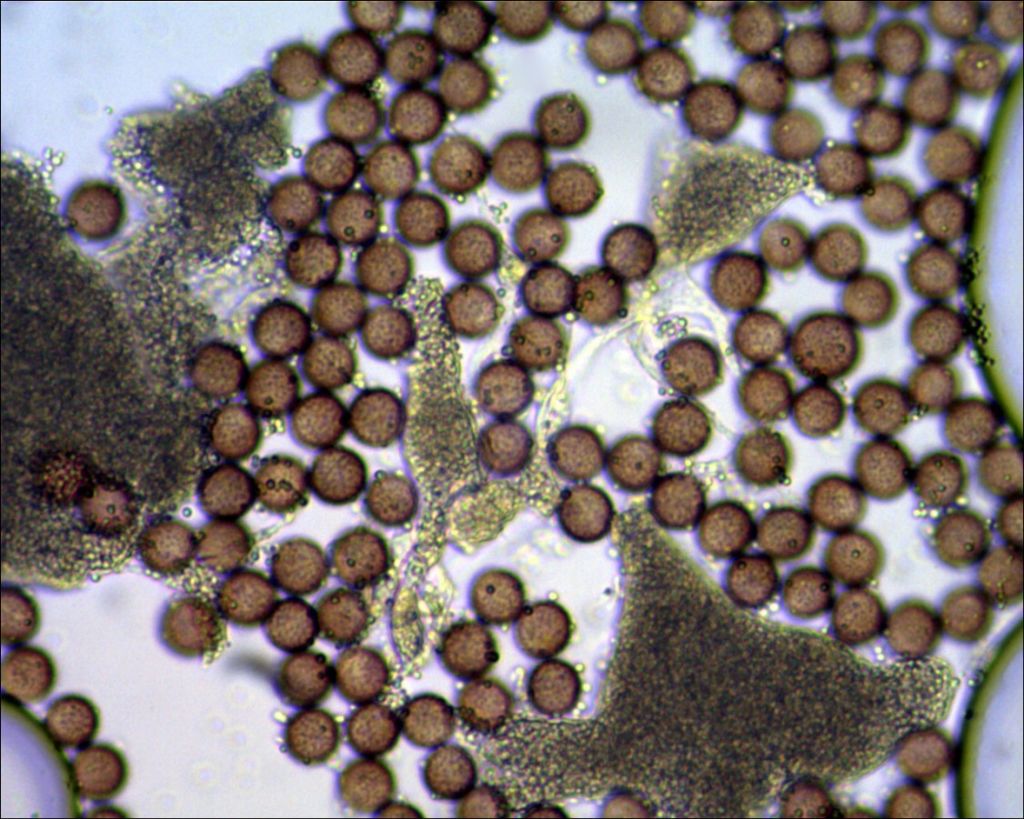 Badhamia or Physarum?